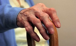 Артрит и артроз пальцев у пожилого человека. 